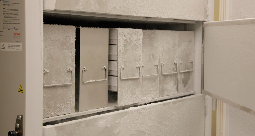 the open freezer door showing five pull-out drawers of tissue samples