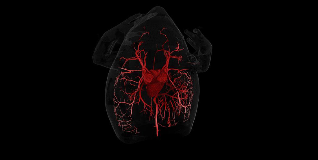 A CT scan of a toad showing its circulatory system