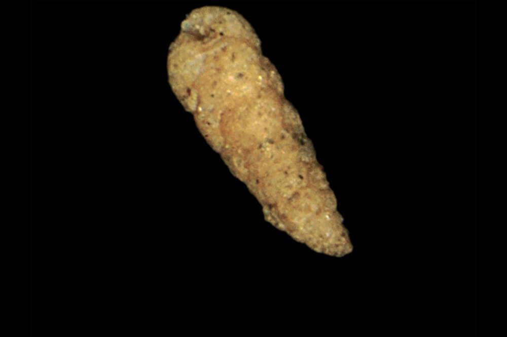 microscopic cone-shaped shell