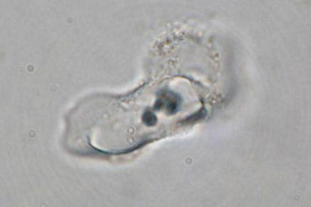 a microscopic image of a phytolith