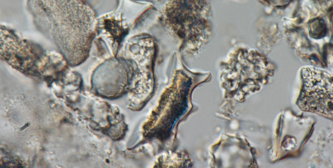 A view of a fossil plant silica under a microscope