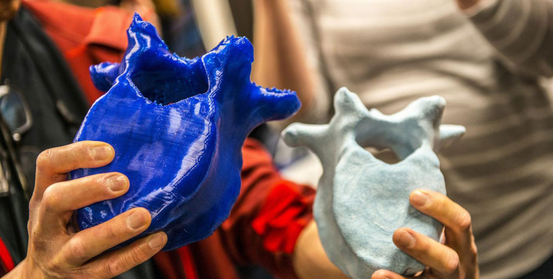 a person holds up two 3D printed vertebra