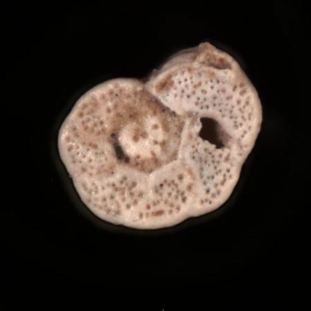 A view through a microscope of a circular organisim with small black dots