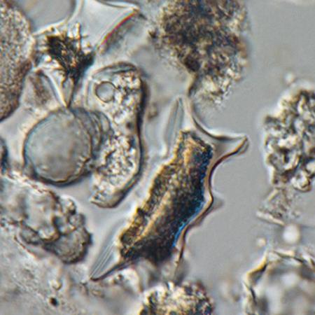 A view of a fossil plant silica under a microscope