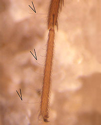 Microscope photo of spider leg with trichobothria